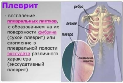 На какие симптомы стоит обратить внимание