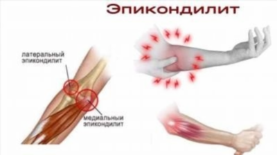 Классификация болевых ощущений и особенности их проявления