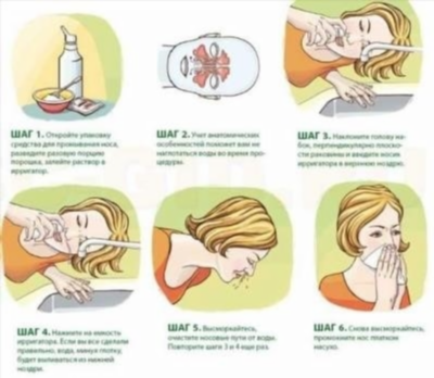При носовом кровотечении: первая помощь, инструкция