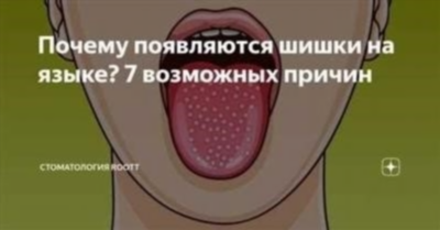 Причины и факторы риска