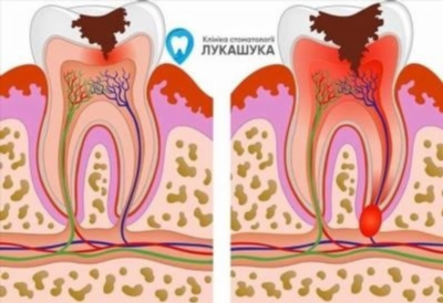 Профилактика и лечение