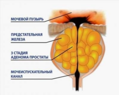 Симптомы у женщин