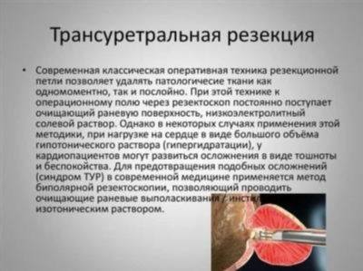 Профилактика аденомы простаты у мужчин