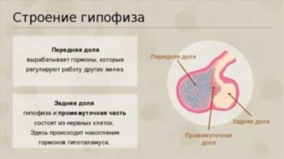 Симптомы аденомы гипофиза