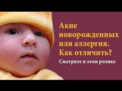 Акне новорожденных: причины и советы для родителей