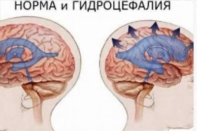 Важность своевременной диагностики