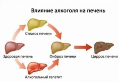 Советы по восстановлению печени после отравления алкоголем