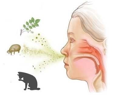 Патогенез кашлевого синдрома