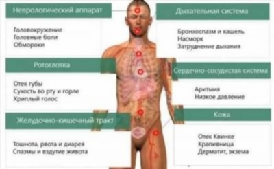 Симптомы и диагностика аллергии на глютен