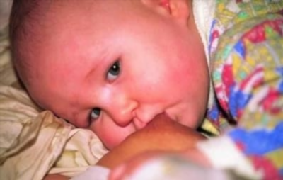 Аллергия на смесь у грудного ребенка: причины возникновения