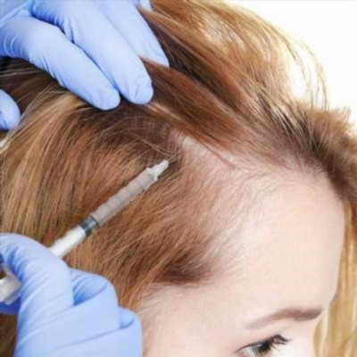 Выпадение волос у женщин в соответствии с женским типом