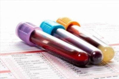 Что может повлиять на результат анализа крови на С-реактивный белок (СРБ)?