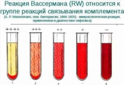 Как показывает анализ крови на стерильность состояние организма?