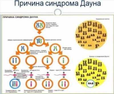 Первый пренатальный скрининг