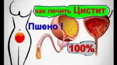 Ультрозвуковая диагностика мочевыводящей системы – визуализация структур органов