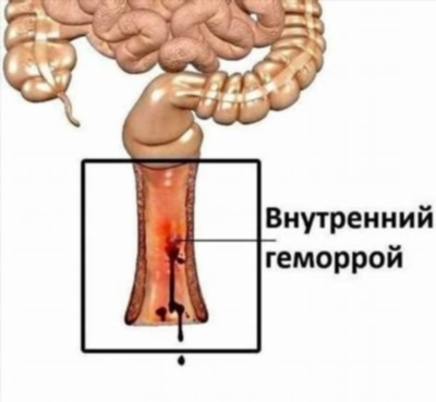 Помощь на дому