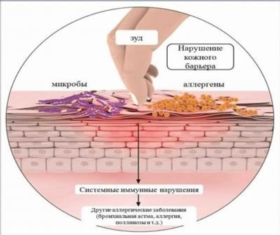 Анальный зуд – причины