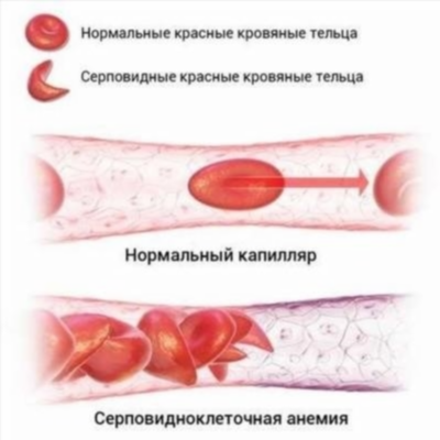 Прогноз и профилактика анемии