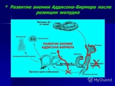 Причины пернициозной анемии