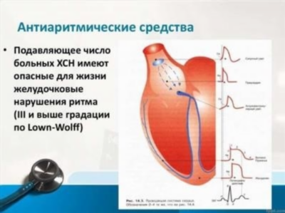 Важные моменты при выборе антиаритмического препарата