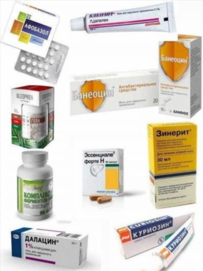 Эффективные антибиотики против прыщей: обзор мазей, таблеток и уколов