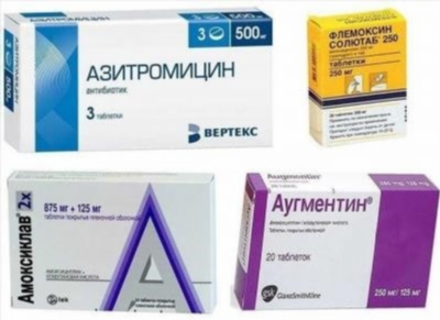Заказ в аптеках: виды и назначение антибиотиков для лечения пародонтита