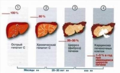 Основные методы тестирования на антитела к вирусу гепатита С