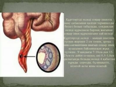 Аппендицит - разберитесь в симптомах и примите необходимые меры