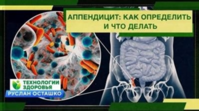 Симптомы аппендицита, которые стоит узнать