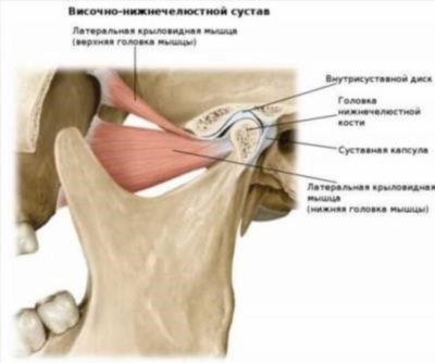 Симптомы артрита ВНЧС