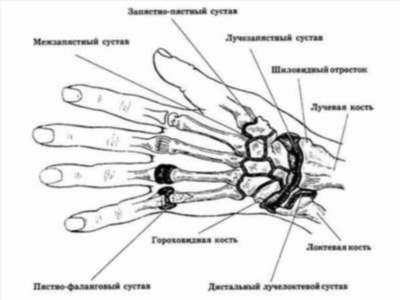 Чем снять боль при воспалении суставов пальцев рук?