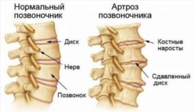 Симптомы и клинические признаки