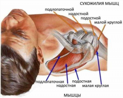 Причины возникновения артроза плечевого сустава