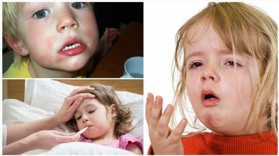 Симптомы аскаридоза у детей