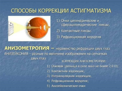 Как происходит диагностика астигматизма?