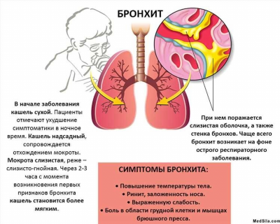 Лечение астматического бронхита