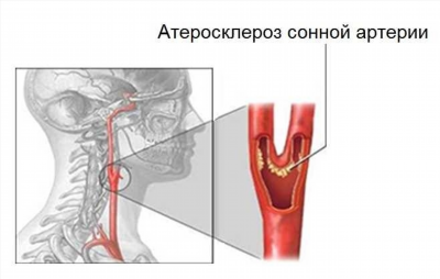 Здоровый образ жизни!