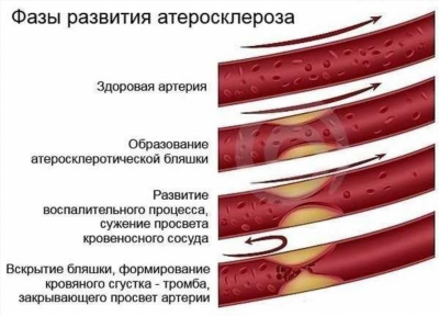 Когда нужно обратиться к врачу