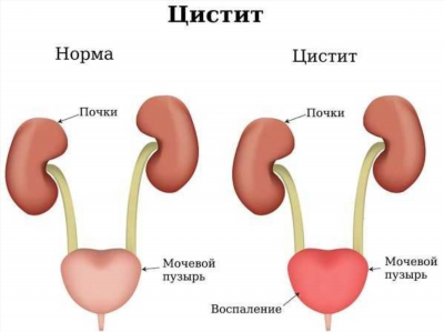 Определение болезни. Причины заболевания