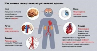 Другие формы гипотиреоза: болезнь в справочнике МКБ-10 РЛС